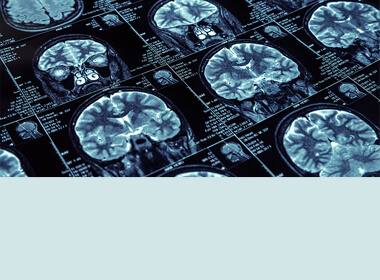 Neurosurgical Concerns-I